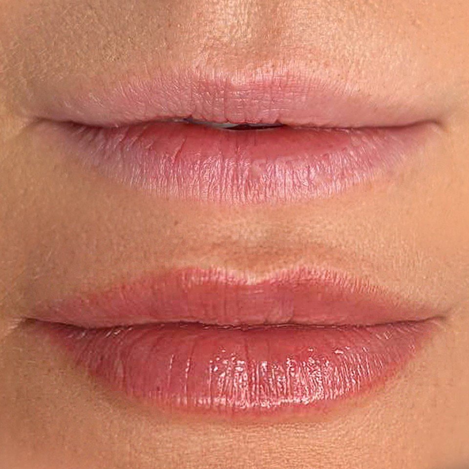 Lips before and after Perma Lips